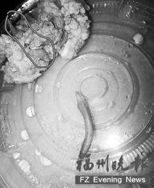 孕妇吃猪肉吃出虫子 做了一晚虫子梦