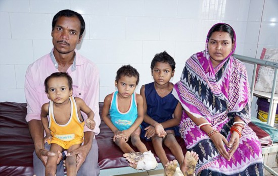 印三姐妹患罕见先天皮肤病 脚掌异常增厚长肿