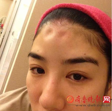 黄奕回应整容传闻承认打玻尿酸 曾被家暴打出