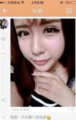 "蛇精女"李蒽熙整容前后大对比 网友:怀念以前的样子【组图】