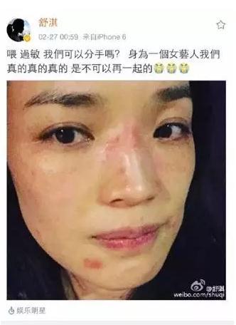 爆痘、过敏、累到脸无光,这些问题咋处理?