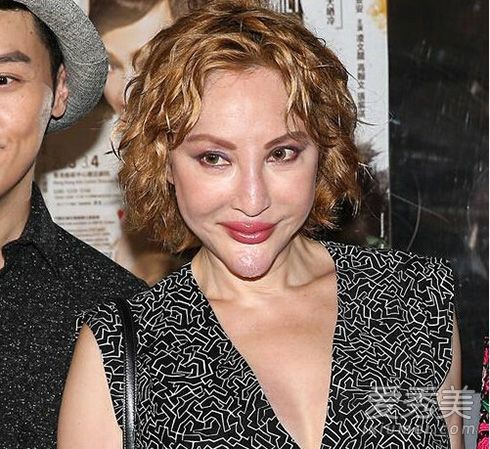 鼻子一捏塌了!郑爽萧蔷女星整容后遗症太可怕