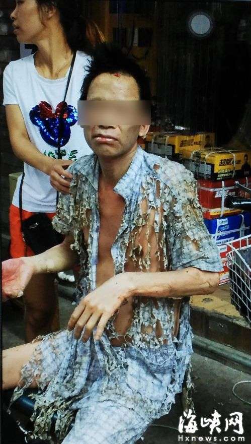 疑煤气罐爆炸福州一男子衣服被气浪撕成烂布条
