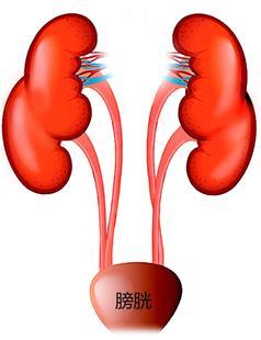 32岁男子体内4个肾 医生称10万人里才遇到一