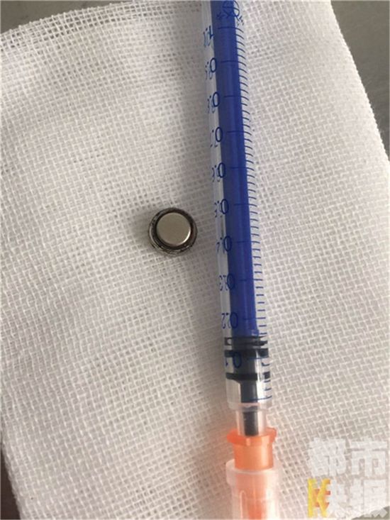 2岁女童将纽扣电池吸入鼻腔手术取出 已有腐蚀