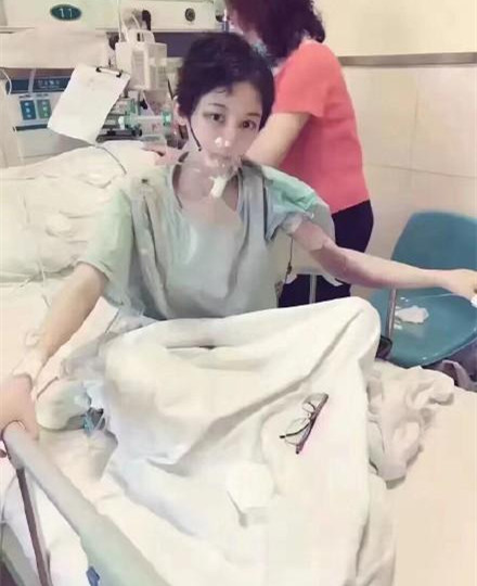 徐婷死因真相甲醛中毒?甲醛中毒的早期症状