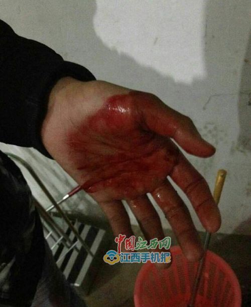 手上也是血迹