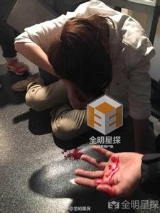 戚薇日本拍戏受伤 送往当地美容医院 戚薇面部