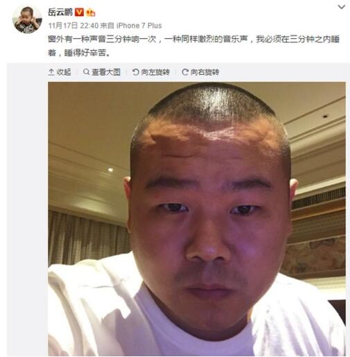 岳云鹏发自拍 网友受到惊吓:美颜软件卸载了?