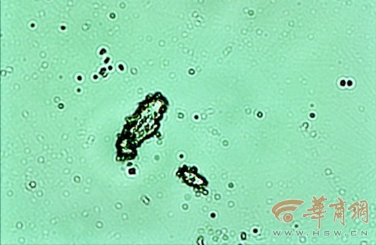 从高空到微观看雪花 洁白雪花含杂质细菌切勿