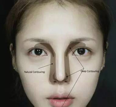 这些塌鼻子女星照样美上天 邓丽君李小璐王菲