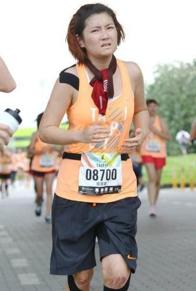 明星拍戏惨受伤:武大校花被砸头 Selina被烧伤