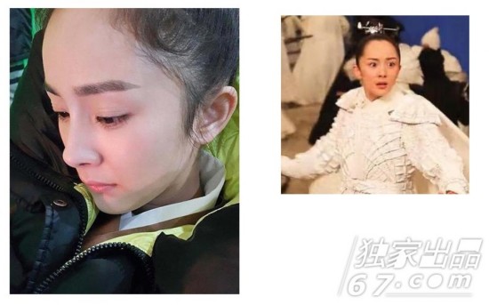 大脑门更美?杨幂郑爽刘诗诗 发际线和人气一起