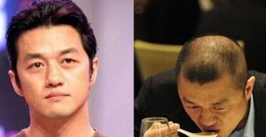 杨幂的发际线像秃头上热搜 细数发际线遭吐槽的明星(图)