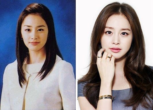 李敏镐权志龙刘仁娜李多海林允儿韩星旧照对比看出整容脸【组图】