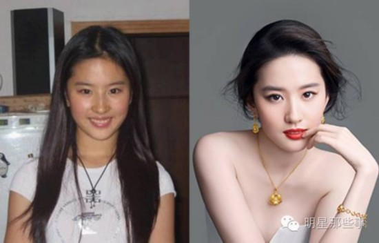 当红明星成名前后对比照 这是化妆还是整容?