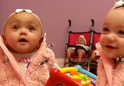 难以置信!美国双胞胎女婴遗传父母不同肤色 由