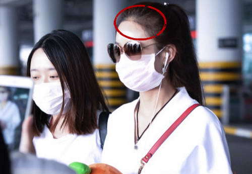 这些当红女星竟是秃脑门:杨幂发际线抢镜赵丽