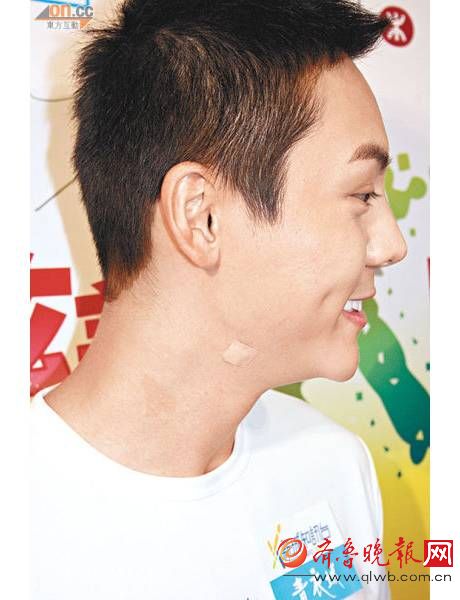 杨幂有一种病(颈部前倾) 原来娜扎、陈伟霆、霉