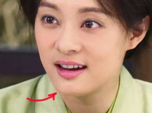嘴上的美人痣分析