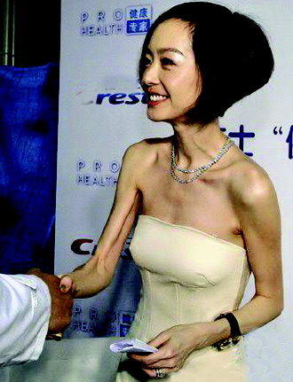 减肥不要命的女星:大s晕倒袁洁莹患厌食症
