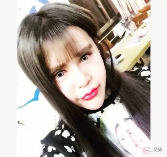 网红花300万整容超50次 颜值却输给蛇精男