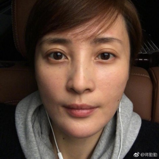 蒋勤勤暖心分享过敏治疗方法 曾因过敏被指大