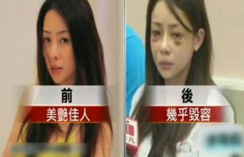 盘点嫁入豪门遭家暴的5大女星:有的离婚获幸福