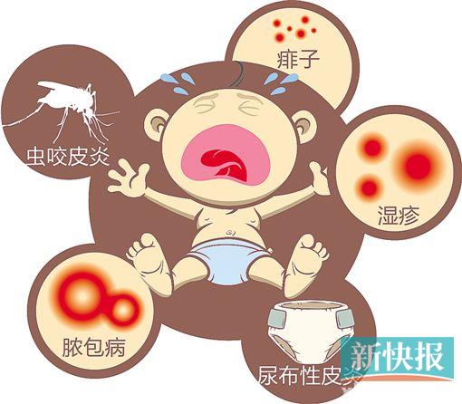 5种宝宝夏日皮肤病可预防
