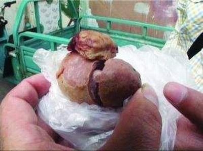 男子杀鸡获鸡宝 小小一块值30万元药用价值未