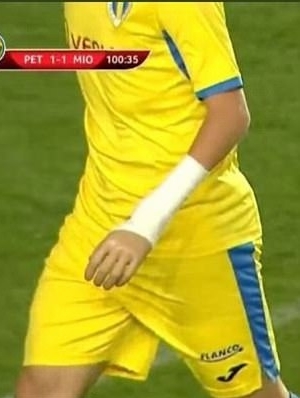 励志!罗马尼亚少年车祸后带假肢登职业足球联