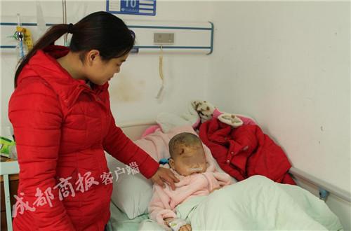 5岁男童被藏獒2次扑倒撕咬缝38针 狗主人:等待