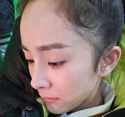 杨幂露刘海发际线高到百会穴 网友:秃头大爷既