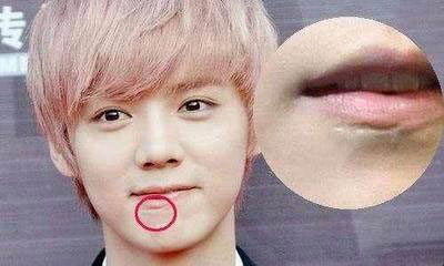 这些明星曾毁容:胡歌疤痕明显 孙俪因祸得福