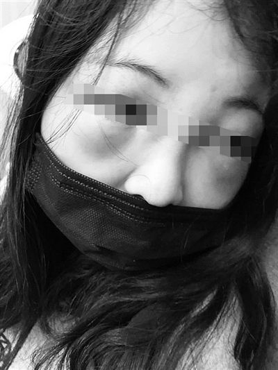 17岁女生因为睡觉打呼噜 被室友带人打成耳膜