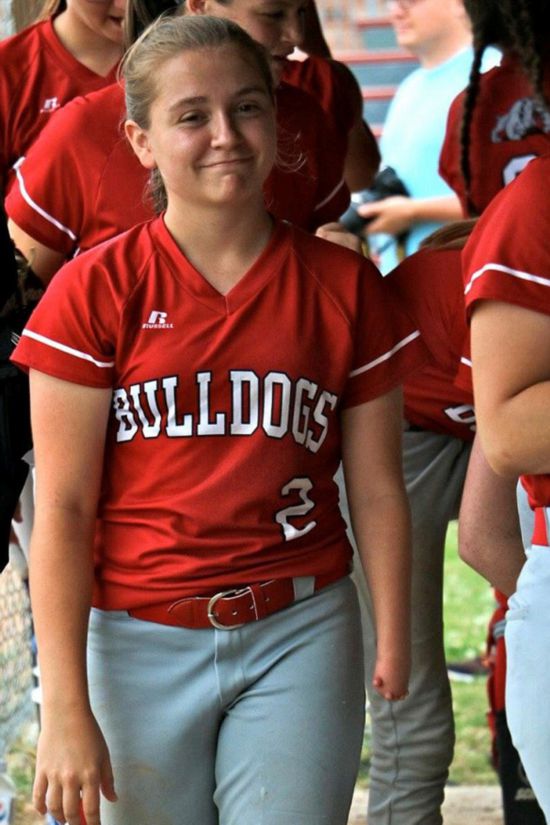 美国女孩为畸形手画搞笑表情编故事走红网络