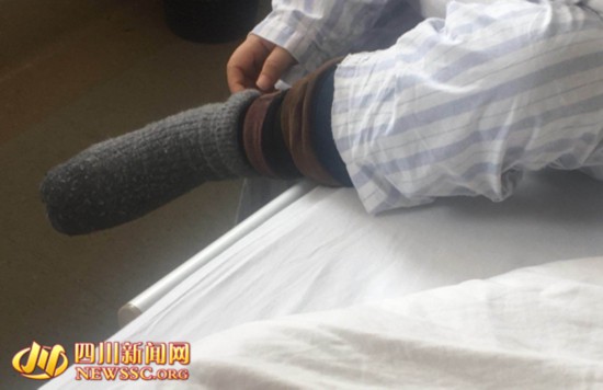女子夏天竟穿8件毛衣医生：躯体形式障碍（图）