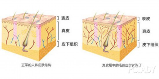 换季皮肤大作战,你准备好了吗?