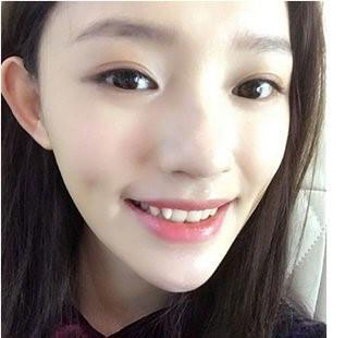 迪丽热巴林心如昆凌 这些明星都悄悄整了牙