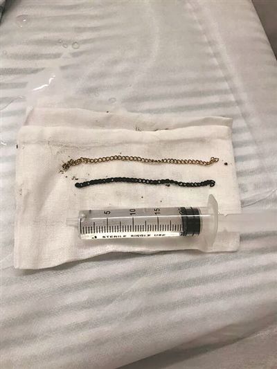 8毫米钢珠配多厚扁皮