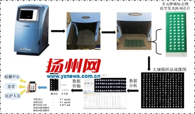 揚大教授研發芯片檢測儀 5分鐘查出腫瘤標志物含量
