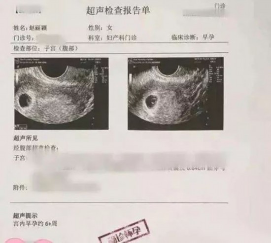 就有传赵丽颖怀孕,网上更流出"赵丽颖b超检查报告"称其已怀孕6周,但