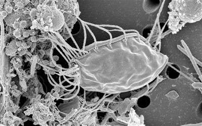 加拿大科学家发现未知真核生物