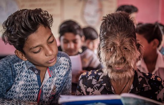 ��ʵ�����ˣ�ӡ13���к��򻼺������������ǳ�ë