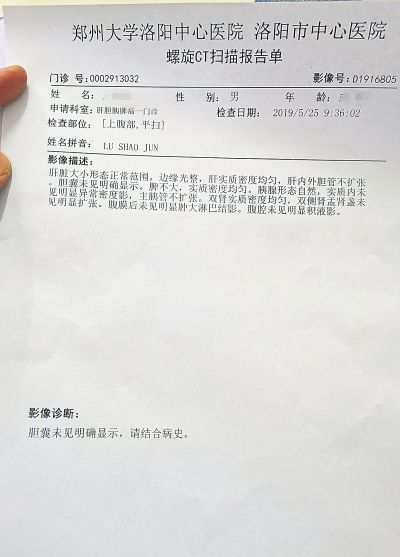 老卢在郑州大学洛阳中心医院做的螺旋ct扫描上腹部的影像结果