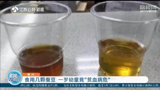常州男童吃蚕豆尿呈酱油色 医生:这叫蚕豆病