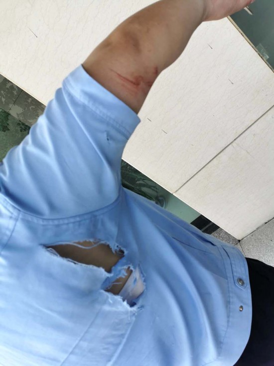 救下女孩后才发现衣服被划破了.