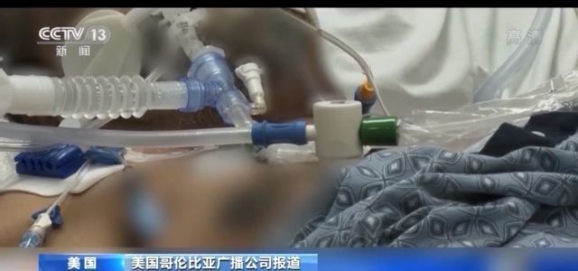 多人现身说法病毒出现时间不断提前究竟谁是美国“零号病人”？