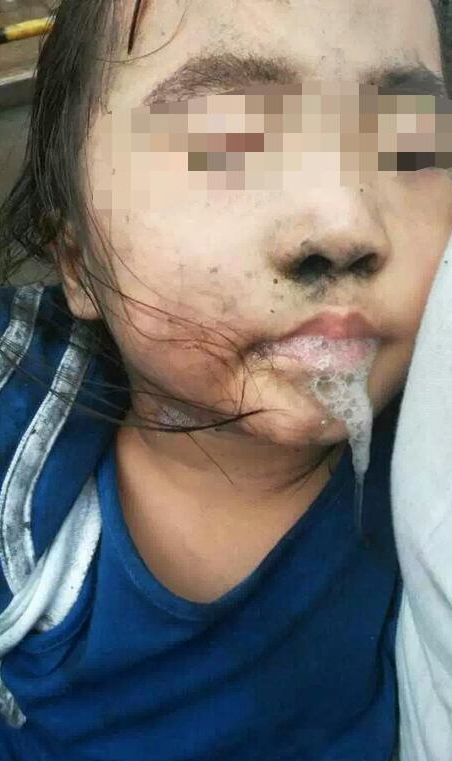 福建宁德一幼儿园著火 儿童全部救出