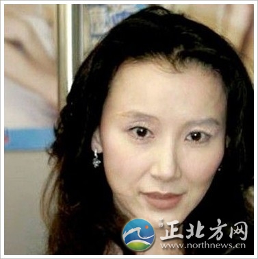 车模李颖芝惨遭毁容 女星整容后面目狰狞[组图]【8】